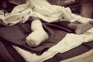 Accidente en Yapacaní: una mujer muere y su niño de 3 años puede perder un pie