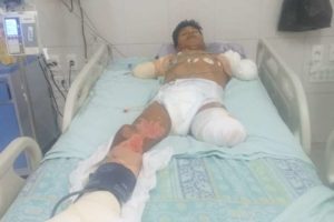 Albañil pierde extremidades después de sufrir descarga eléctrica; no recibe ayuda