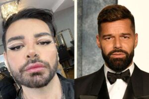 Hombre se somete a más de 30 cirugías para parecerse a Ricky Martin