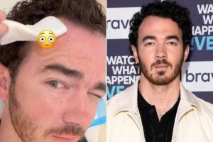 El cantante Kevin Jonas reveló que padece cáncer de piel