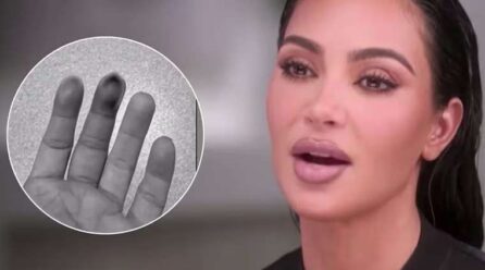 Kim Kardashian se fractura su mano tras golpearse con una puerta